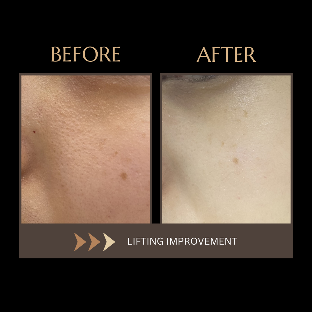 wrinkle solution devices