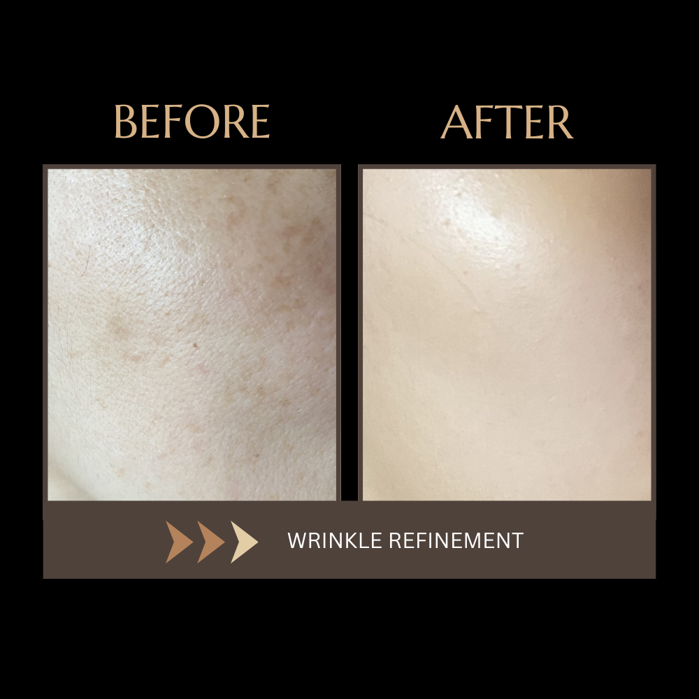 wrinkle solution devices