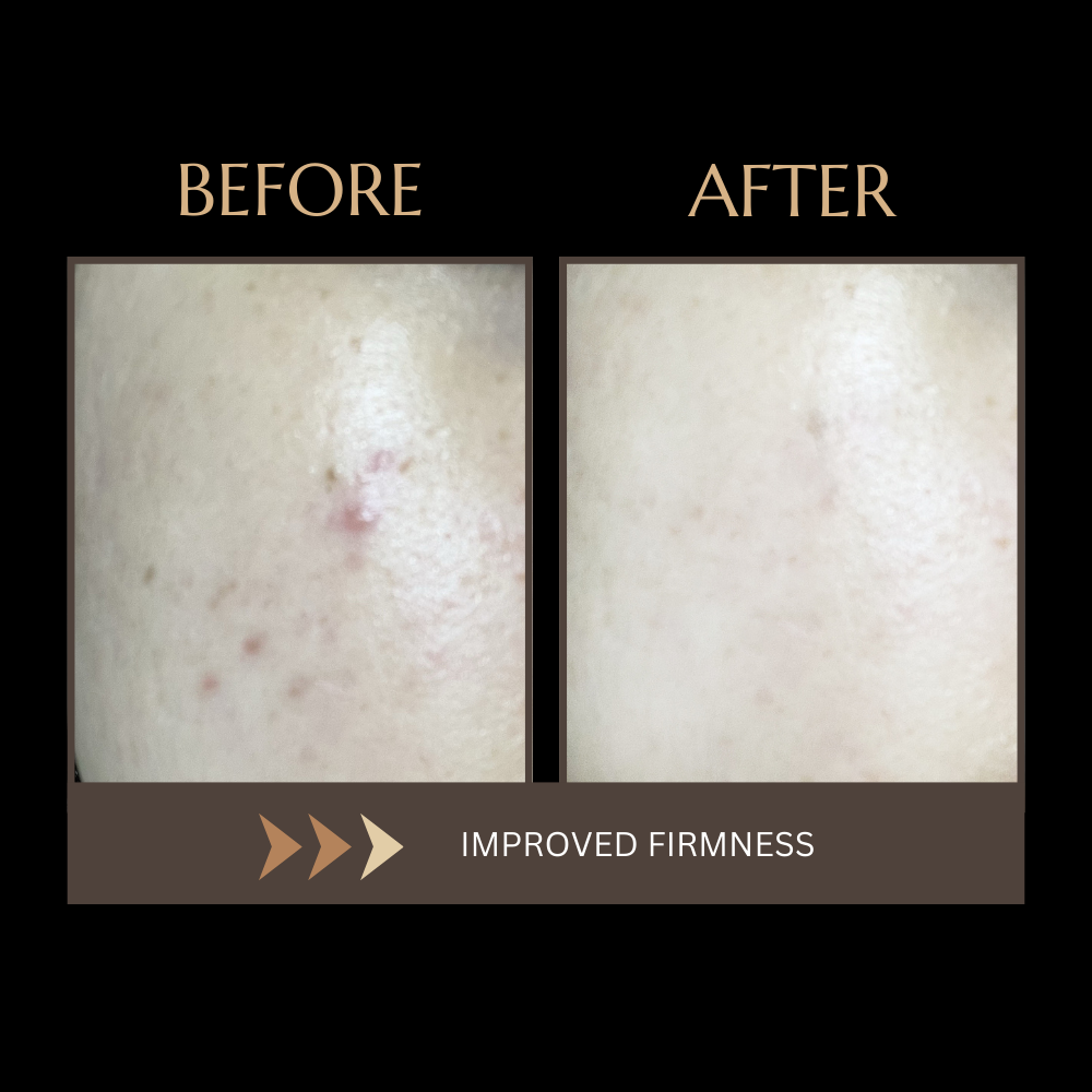 wrinkle solution devices