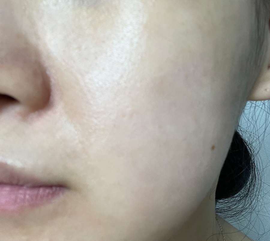 wrinkle solution devices